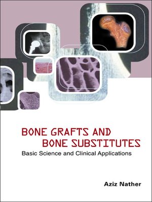 cover image of Bone Grafts and Bone Substitutes